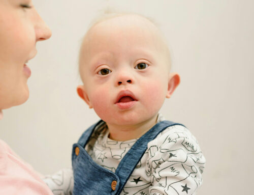 Down Syndrome Motor Skill Milestones